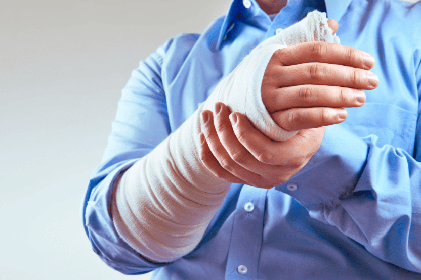 Basics of personal injury lawsuits in Minnesota: image of a man with a broken arm in a cast.