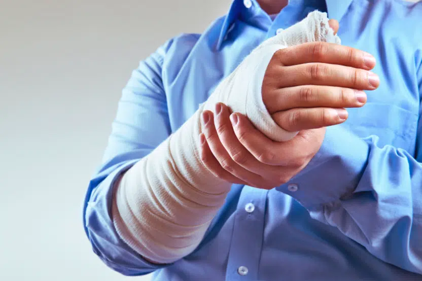 Basics of personal injury lawsuits in Minnesota: image of a man with a broken arm in a cast.