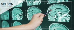 Traumatic brain injury lawyer in Minneapolis