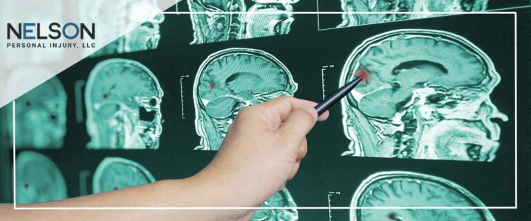 Traumatic brain injury lawyer in Minneapolis