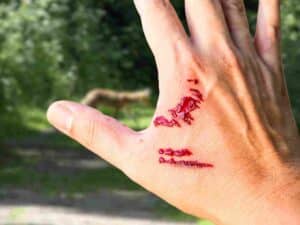 Injury attorney in Buffalo